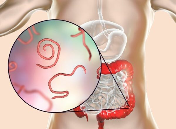 Parasite Cleanse 21-Day Detox: Strengthen, Defend, and Restore