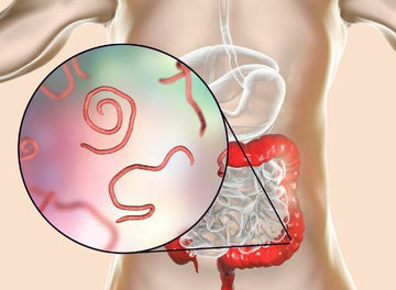 Parasite Cleanse 21-Day Detox: Strengthen, Defend, and Restore